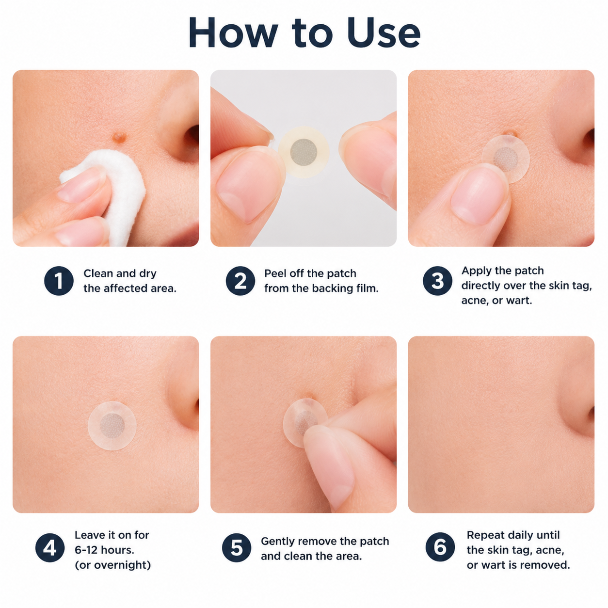 ✨Simpleahaven®2-in-1 Microneedle & Hydrocolloid Patch🍀| Removes Raised Moles, Acne, Flat Warts & Skin Tags | Helps Improve Wrinkles, Scars & Blemishes | Invisible Patches for Face & Body