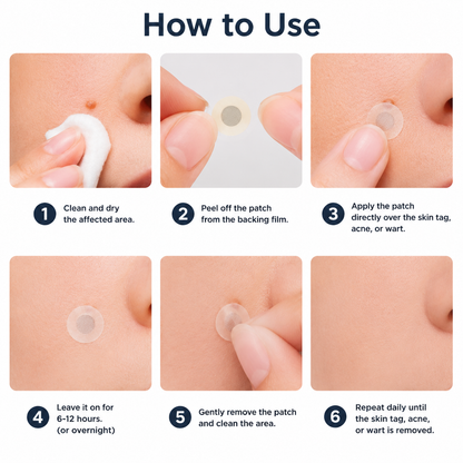 ✨Simpleahaven®2-in-1 Microneedle & Hydrocolloid Patch🍀| Removes Raised Moles, Acne, Flat Warts & Skin Tags | Helps Improve Wrinkles, Scars & Blemishes | Invisible Patches for Face & Body