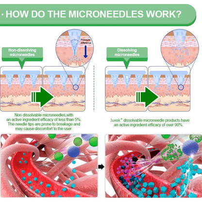 2026 Breakthrough: Lose Stubborn Fat While Keeping Skin Tight – New Oliokindred® BerberineExtract 10-in-1 Nano Microneedle Patch