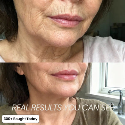 🔥LAST DAY 60% OFF Simpleahaven Korean Pink Collagen Volume Multi Balm