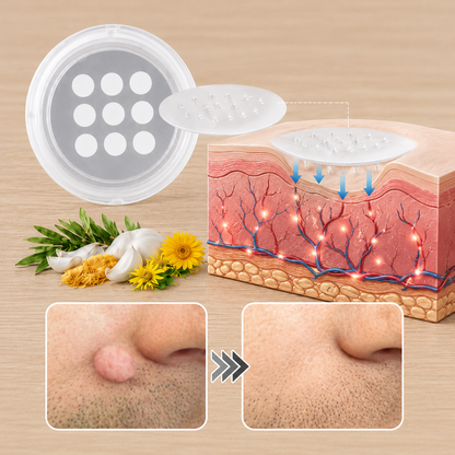 ✨Simpleahaven®2-in-1 Microneedle & Hydrocolloid Patch🍀| Removes Raised Moles, Acne, Flat Warts & Skin Tags | Helps Improve Wrinkles, Scars & Blemishes | Invisible Patches for Face & Body