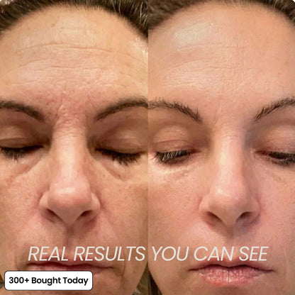 🔥LAST DAY 60% OFF Simpleahaven Korean Pink Collagen Volume Multi Balm