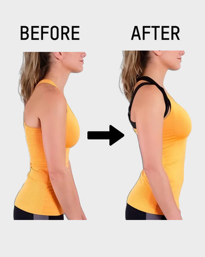 ⏳👍✨Cross Back Front Closure Wireless Posture Support Bra– All-Day Comfort, Breathable & Summer-Ready 💕